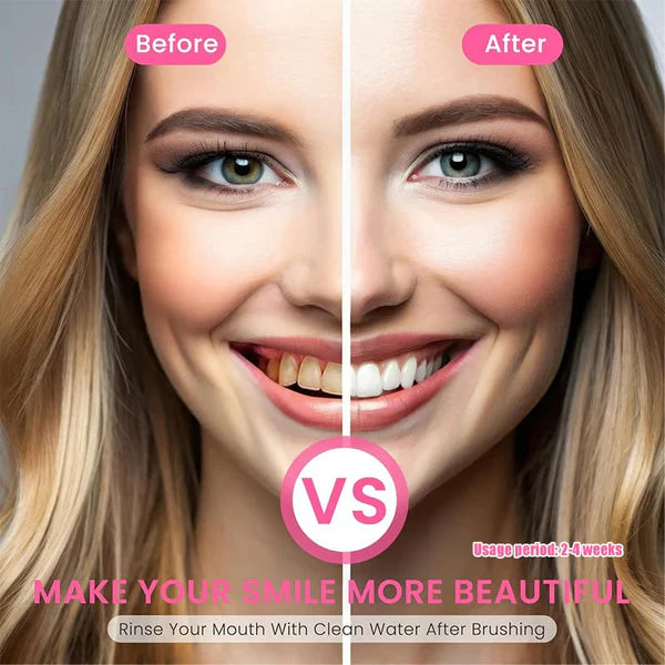 Niacinamide Whitening Toothpaste - For Healthier, Whiter Teeth!
